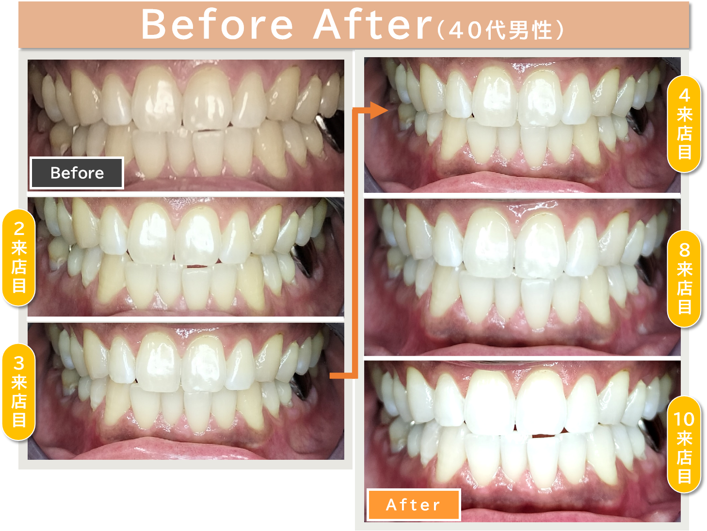 Before After